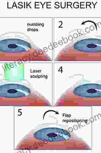 Surgical Correction of Astigmatism Nick Pulford