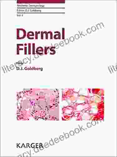 Dermal Fillers (Aesthetic Dermatology 4)