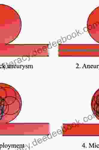 Therapeutic Embolization Nick Pulford