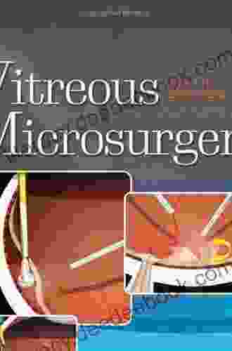 Vitreous Microsurgery Tancred Bradshaw